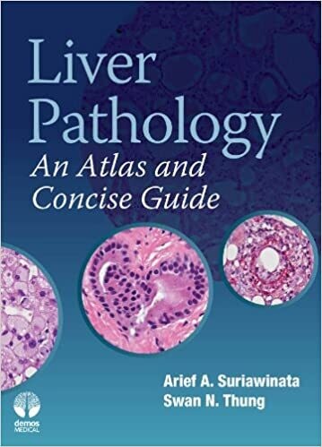 Liver Pathology: An Atlas and Concise Guide 1st Edition