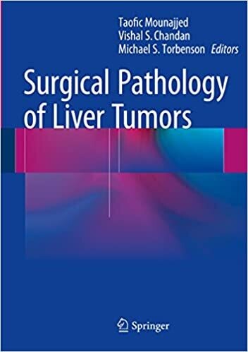Surgical Pathology of Liver Tumors 1st ed. 2015 Editionx