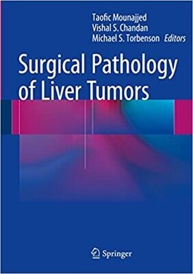 Surgical Pathology of Liver Tumors 1st ed. 2015 Editionx
