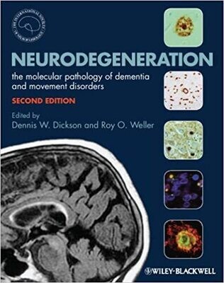 Neurodegeneration: The Molecular Pathology of Dementia and Movement Disorders 2nd Edition