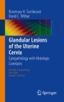 Glandular Lesions of the Uterine Cervix
Cytopathology with Histologic Correlates