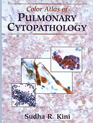 Color Atlas of Pulmonary Cytopathology 2002nd Edition