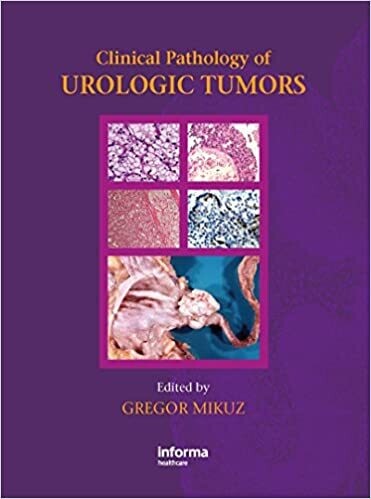 Clinical Pathology of Urological Tumours 1st Edition