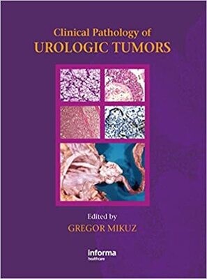Clinical Pathology of Urological Tumours 1st Edition