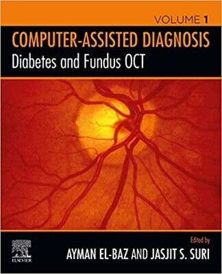 Diabetes and Fundus OCT (Computer-Assisted Diagnosis) 1st Edition