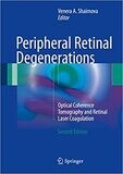 Peripheral Retinal Degenerations: Optical Coherence Tomography and Retinal Laser Coagulation 2nd Edition