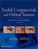 Eyelid, Conjunctival, and Orbital Tumors: An Atlas and Textbook 3rd Edition