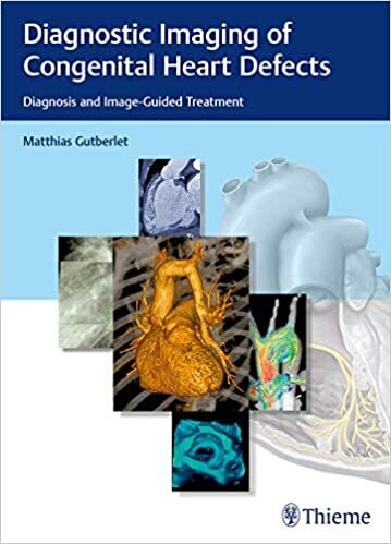 Diagnostic Imaging of Congenital Heart Defects