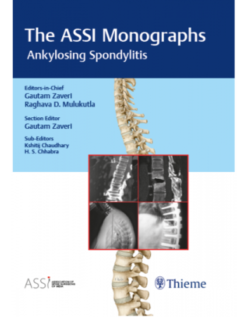 The ASSI Monographs: Ankylosing Spondylitis