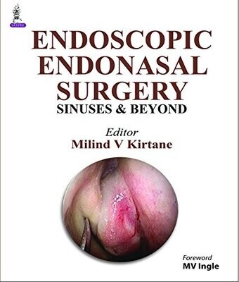 Endoscopic Endonasal Surgery: Sinuses and Beyond 1st Edition