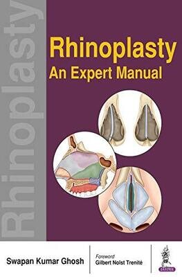 Rhinoplasty—An Expert Manual