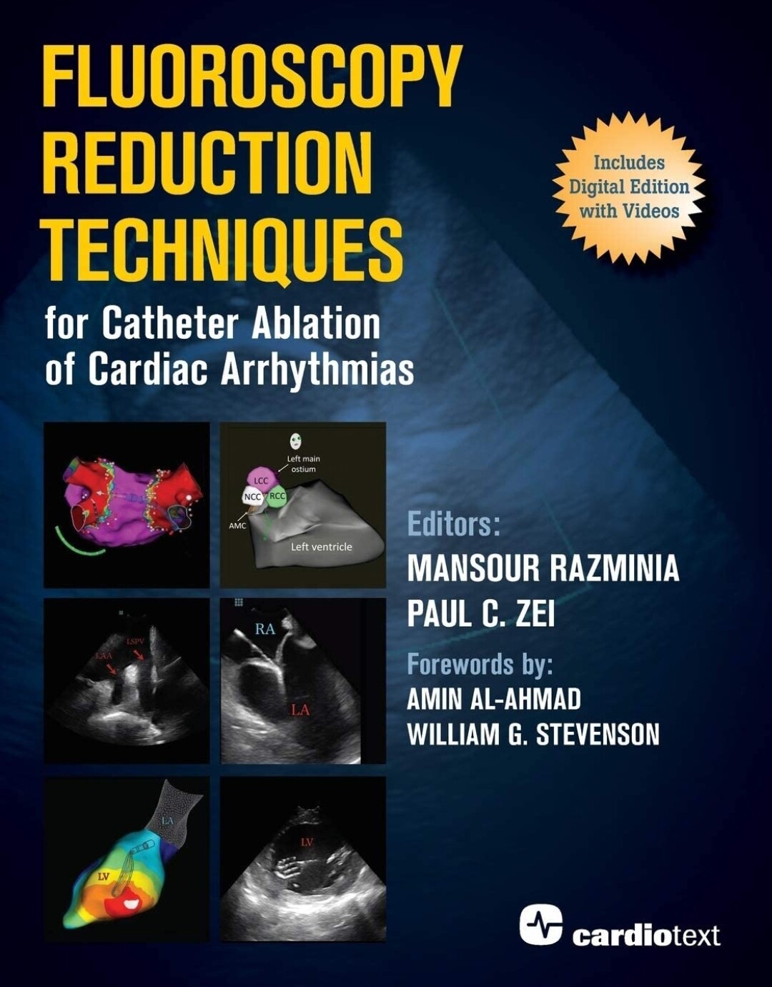 Fluoroscopy Reduction Techniques for Catheter Ablation of Cardiac