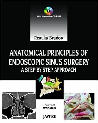 Anatomical Principles of Endoscopic Sinus Surgery A Step by Step Approach
