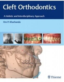 Cleft Orthodontics A Holistic and Interdisciplinary Approach