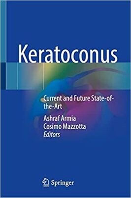Keratoconus: Current and Future State-of-the-Art