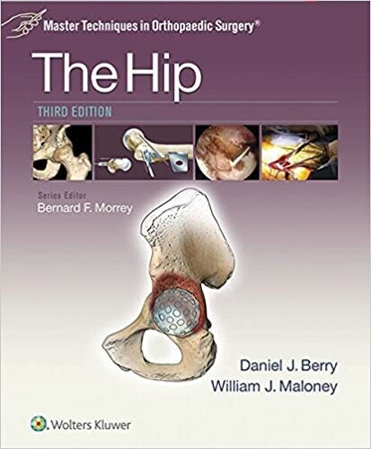 Master Techniques in Orthopaedic Surgery: The Hip 3rd Edition
