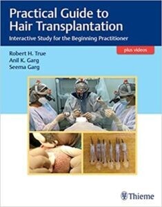 Practical Guide to Hair Transplantation: Interactive Study for the Beginning Practitioner