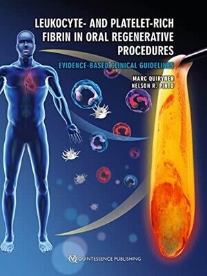 Leukocyte- and Platelet-Rich Fibrin in Oral Regenerative Procedures: Evidence-Based Clinical Guidelines