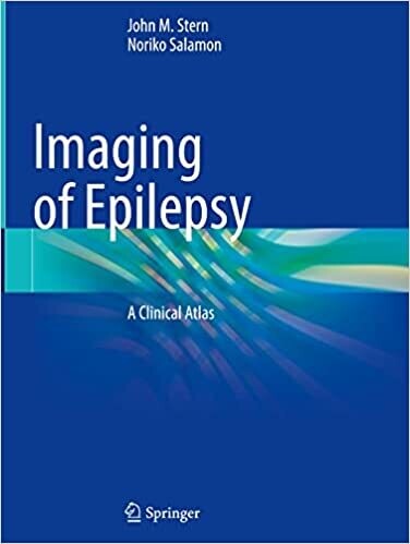 Imaging of Epilepsy