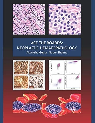 ACE the Boards: Neoplastic Hematopathology