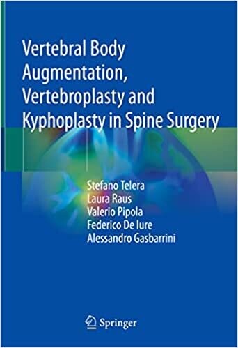 Vertebral Body Augmentation, Vertebroplasty and Kyphoplasty in Spine Surgery 1st ed. 2021 Edition
