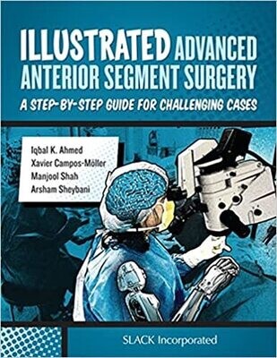 Illustrated Advanced Anterior Segment Surgery: A Step-by-Step Guide for Challenging Cases 1st Edition