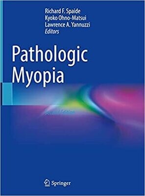 Pathologic Myopia 2nd Edition