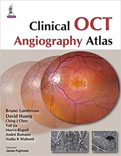 Clinical OCT Angiography Atlas 1st Edition