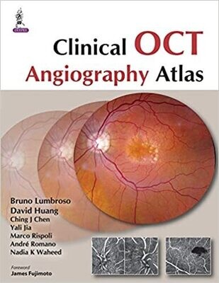 Clinical OCT Angiography Atlas 1st Edition