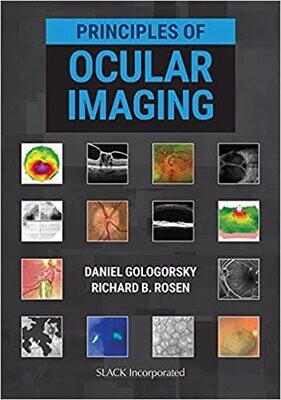 Principles of Ocular Imaging