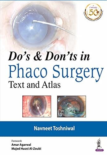 DO&#39;s &amp; DON&#39;Ts in Phaco Surgery: Text and Atlas