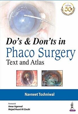 DO&#39;s &amp; DON&#39;Ts in Phaco Surgery: Text and Atlas