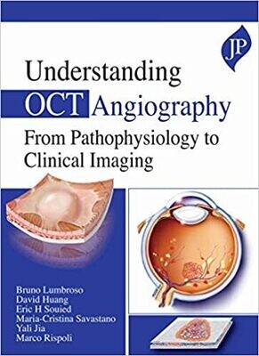 Understanding OCT Angiography From Pathophysiology to Clinical Imaging 1st Edition