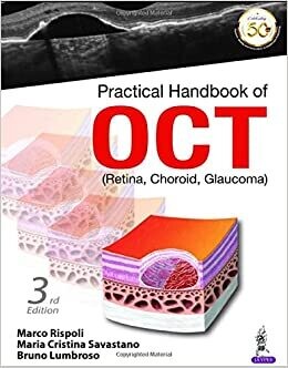 PRACTICAL HANDBOOK OF OCT (RETINA,CHORID,GLAUCOMa)