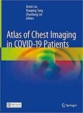 Atlas of Chest Imaging in COVID-19 Patients 1st ed. 2021 Edition