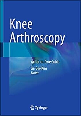 Knee Arthroscopy: An Up-to-Date Guide 1st ed