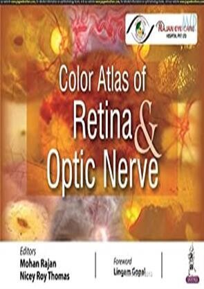 Color Atlas Of Retina &amp; Optic Nerve