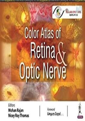 Color Atlas Of Retina &amp; Optic Nerve