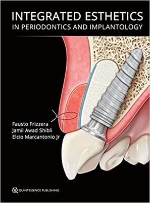 Integrated Esthetics in Periodontics and Implantology 1st Edition
