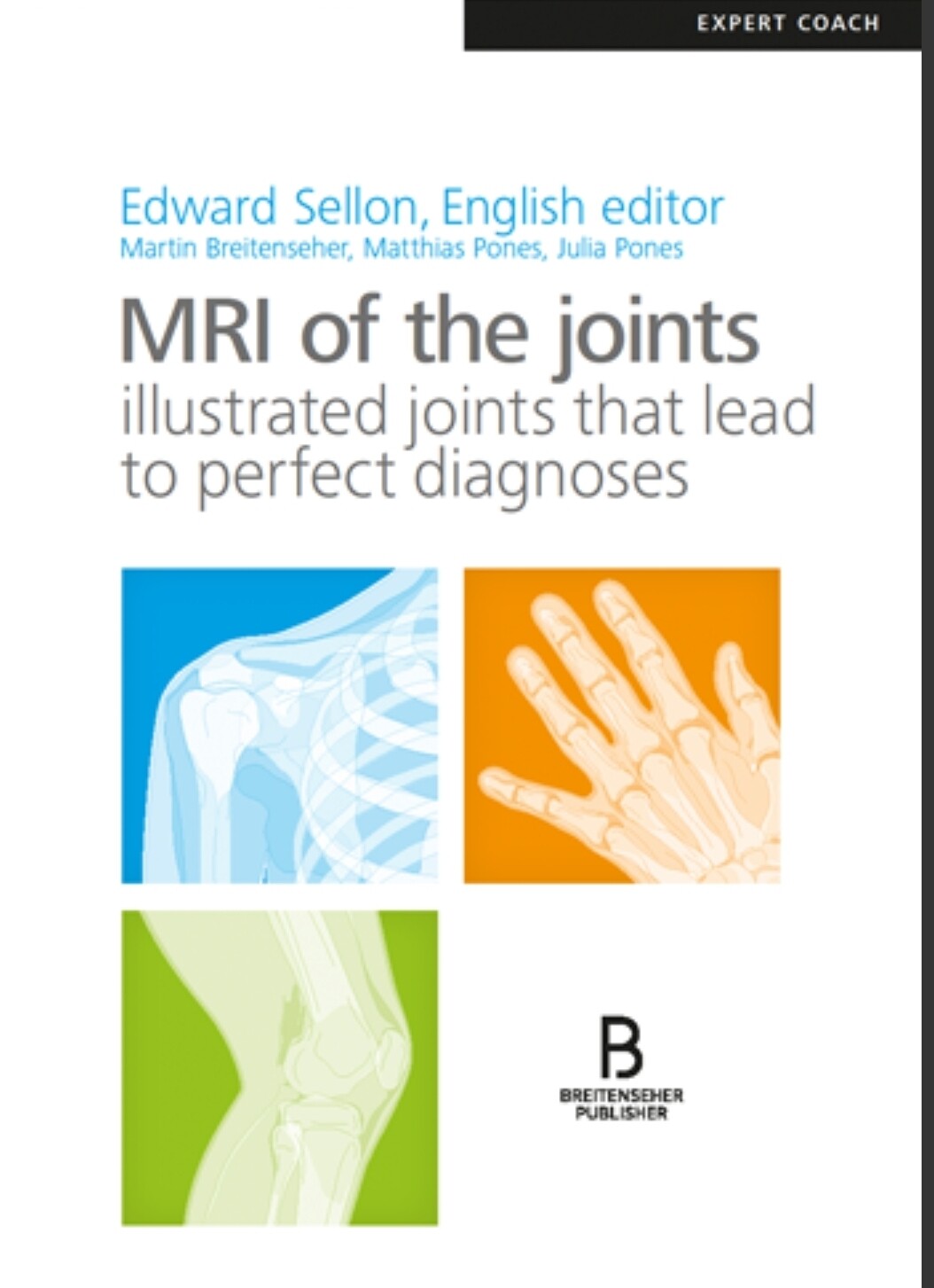 MRI of the Joints