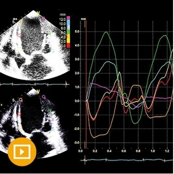 Echocardiography- A Comprehensive Review 2022 CME Videos Course