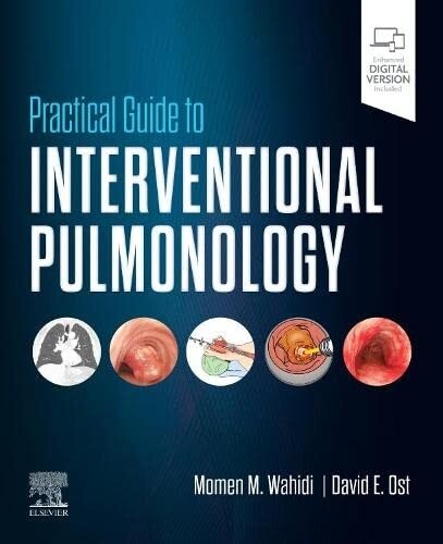Practical Guide to Interventional Pulmonology 2023