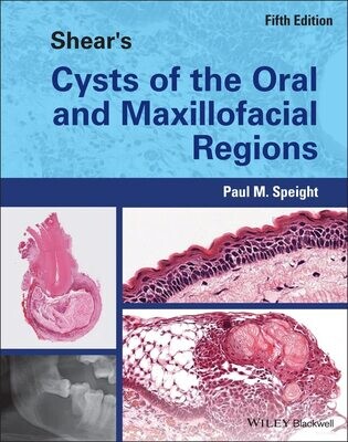 Shear&#39;s Cysts of the Oral and Maxillofacial Regions 5th Edition