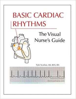 Basic Cardiac Rhythms: The Visual Nurse&#39;s Guide (The Visual Nurse&#39;s Basic ECG Series)