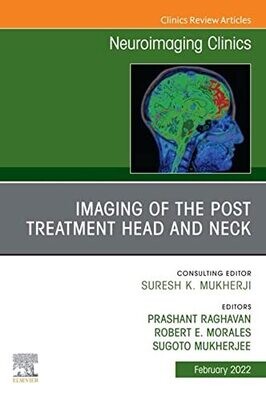 Imaging of the Post Treatment Head and Neck, An Issue of Neuroimaging Clinics of North America
