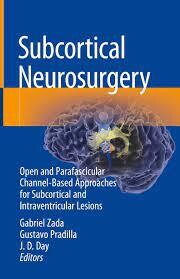 Subcortical Neurosurgery
Open and Parafascicular Channel-Based Approaches for Subcortical and Intraventricular Lesions