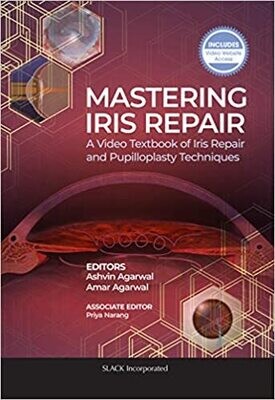 Mastering Iris Repair: A Video Textbook of Iris Repair and Pupilloplasty Techniques 1st Edition