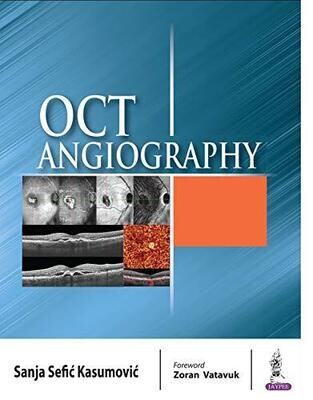 OCT Angiography