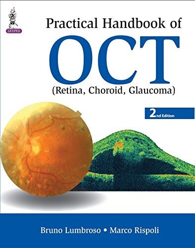 Practical Handbook of OCT: (Retina, Choroid, Glaucoma) 2nd Edition