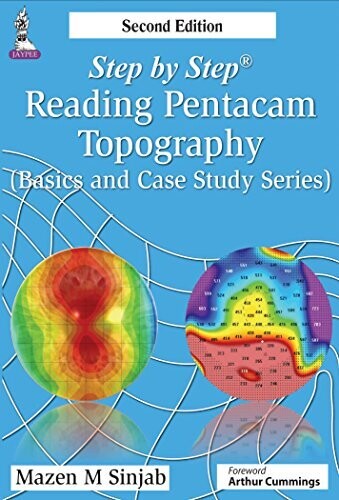 Step by Step Reading Pentacam Topography (Basics and Case Study Series) 2nd Edition